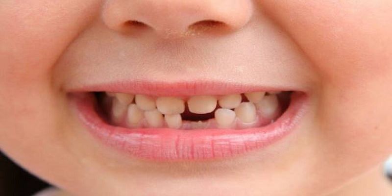 Mơ thấy rụng răng báo hiệu điều gì?